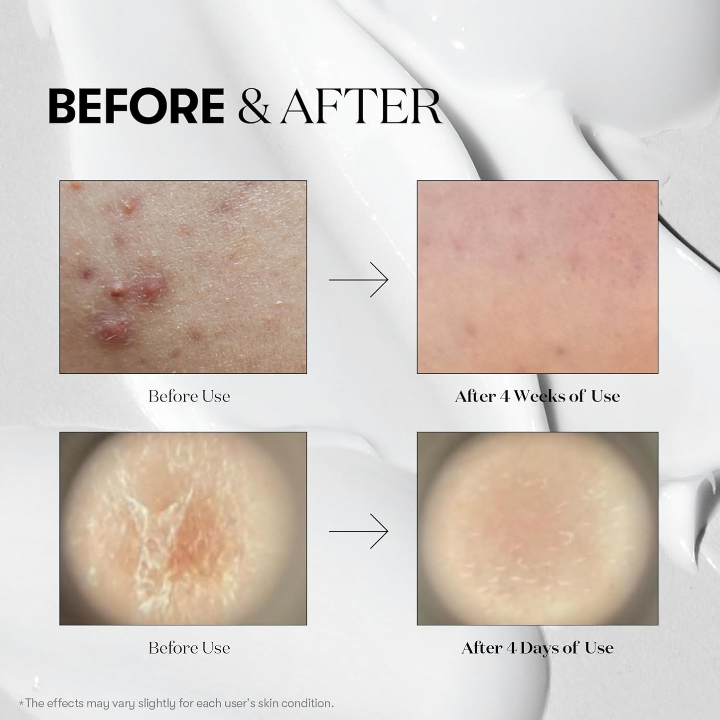 SKINCLARITY REEDLE BOOST SERUM