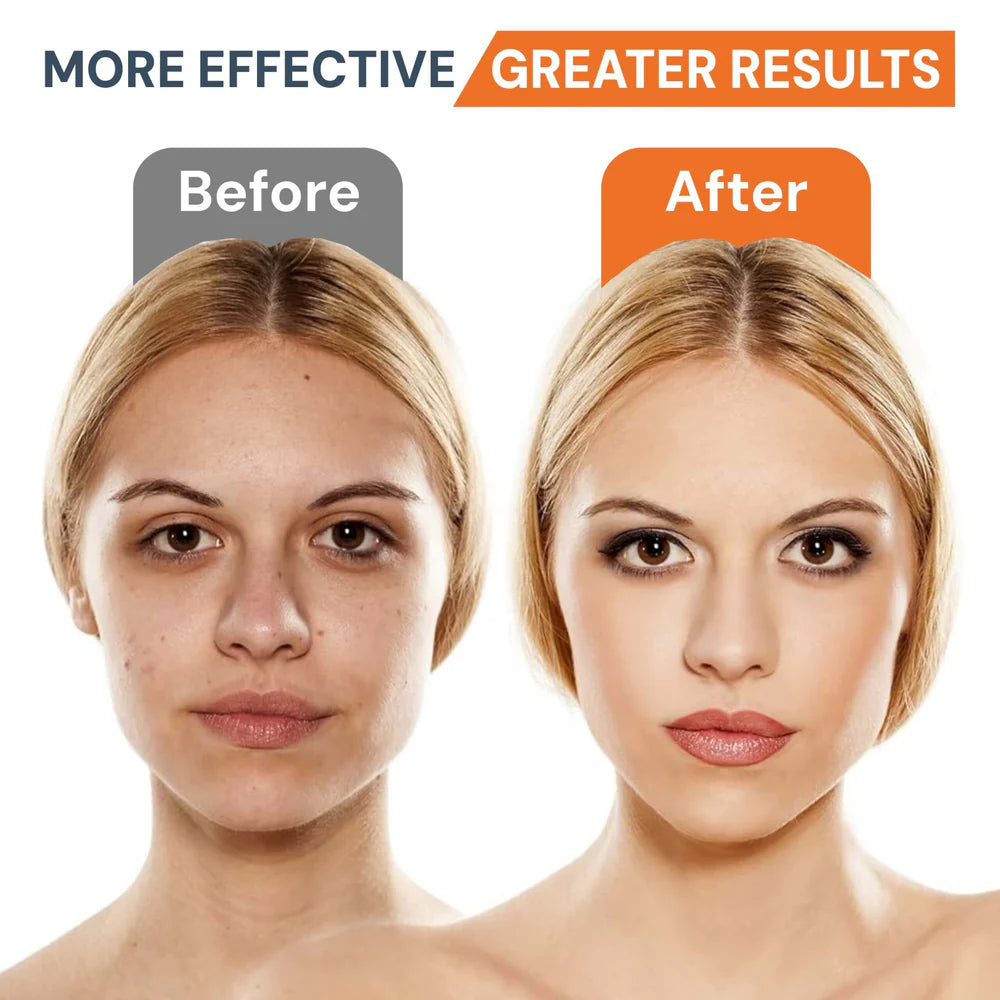 Before and after comparison of a woman's face with text 'More Effective' and 'Greater Results'.