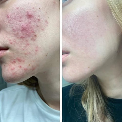 Before and after testimonial