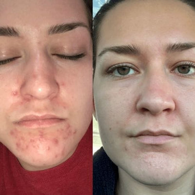 Before and after testimonial