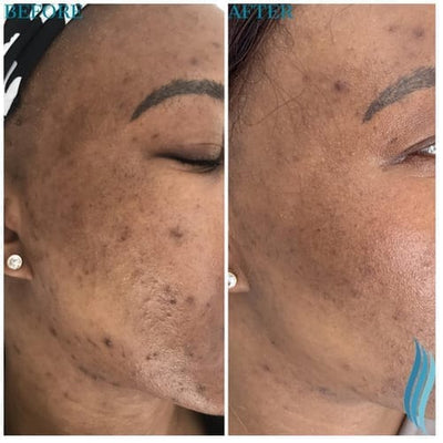 Before and after testimonial