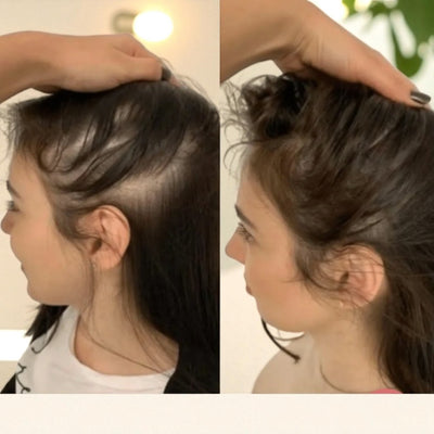 Before and after testimonial