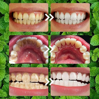 Before and after comparison of teeth whitening on a green leafy background