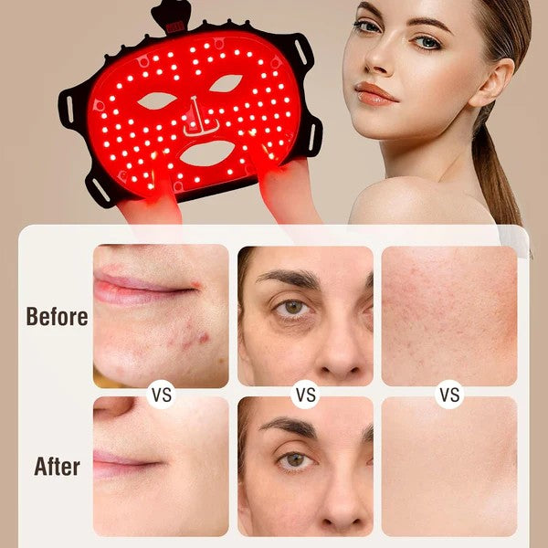 LED face mask with before and after effects on skin shown on a woman's face.