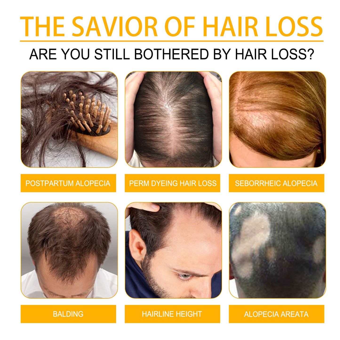 Promotional image about hair loss solutions with various types of hair loss shown.