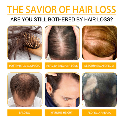 Promotional image about hair loss solutions with various types of hair loss shown.