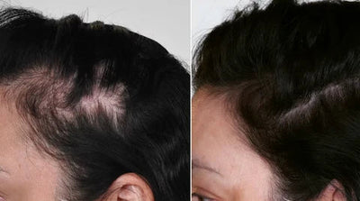 Before and after testimonial