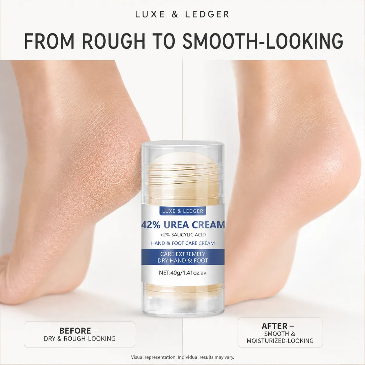 SOFTHEEL FOOT CREAM