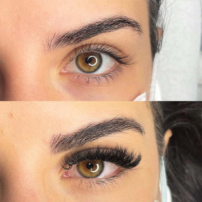 Before and after testimonial