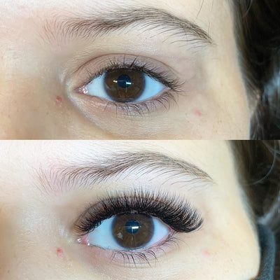 Before and after testimonial