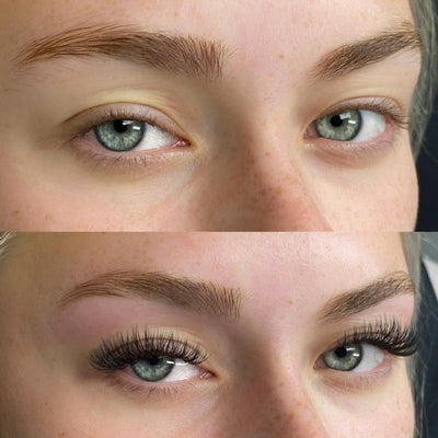 Before and after testimonial