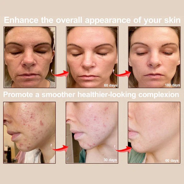 Before and after comparison of skin treatment results with text on a beige background