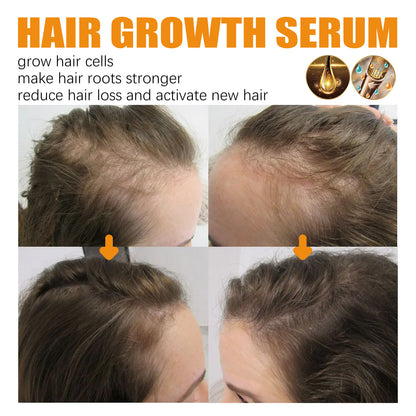 Advertisement for hair growth serum showing before and after effects on hair thickness.