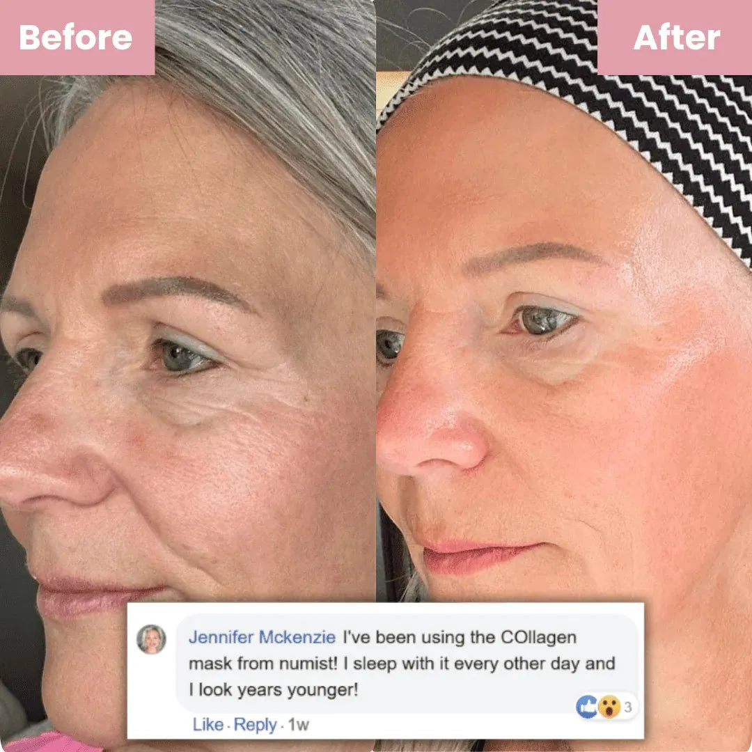 Before and after comparison of a woman's face with text overlay about using a COllagen mask.