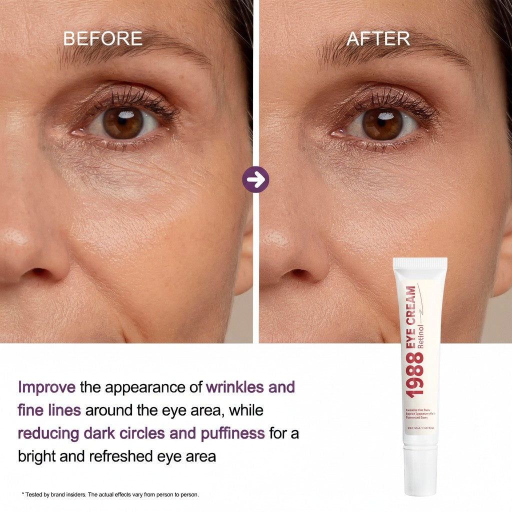 Before and after comparison of eye area with 1988 Eye Cream tube displayed.
