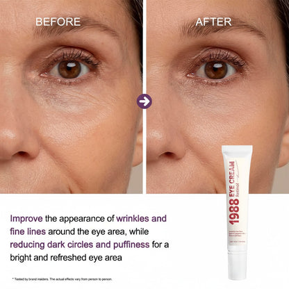 Before and after comparison of eye area with 1988 Eye Cream tube displayed.