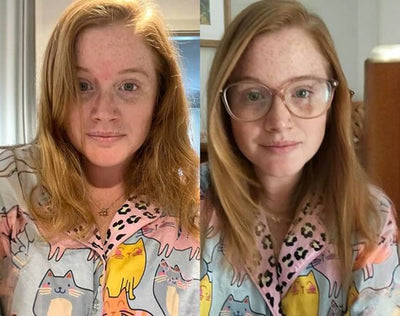 Before and after testimonial