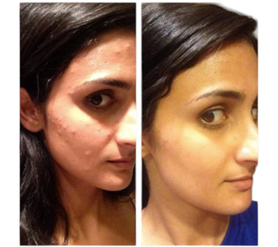 Before and after testimonial